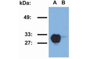 Western Blotting (WB) image for anti-Major Histocompatibility Complex, Class II, DR beta 1 (HLA-DRB1) antibody (ABIN238469) (HLA-DRB1 抗体)