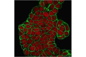 Immunofluorescent staining of PFA-fixed MCF-7 cells. (CD47 抗体)
