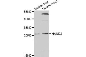 Western blot analysis of extracts of various cell lines, using HAND2 antibody (ABIN3214288) at 1/1000 dilution. (HAND2 抗体)