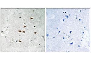 Immunohistochemistry (IHC) image for anti-Itchy E3 Ubiquitin Protein Ligase Homolog (ITCH) (pTyr420) antibody (ABIN1847708) (ITCH 抗体  (pTyr420))