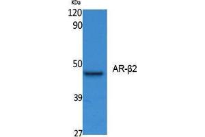 Western Blotting (WB) image for anti-Androgen Receptor beta 2 (Ser127) antibody (ABIN3187616) (Androgen Receptor beta 2 抗体  (Ser127))