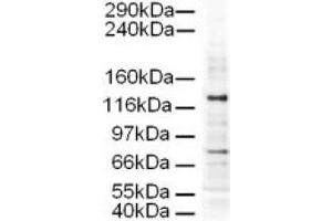 Image no. 1 for anti-Adaptor-Related Protein Complex 3, delta 1 Subunit (AP3D1) (AA 686-698) antibody (ABIN401171)