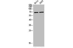 Western Blot analysis of HELA 293T cells using Phospho-PKC ζ (T560) Polyclonal Antibody (PKC zeta 抗体  (pThr560))