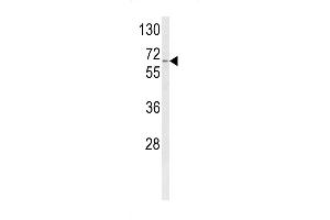Western Blotting (WB) image for anti-Cytochrome P450, Family 4, Subfamily F, Polypeptide 3 (CYP4F3) (AA 77-109), (N-Term) antibody (ABIN652588)
