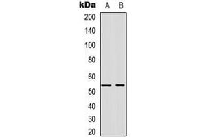 Western blot analysis of Annexin A7 expression in A549 (A), NS-1 (B) whole cell lysates. (Annexin VII 抗体  (Center))