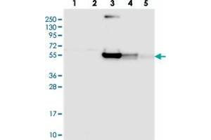 Western blot analysis of Lane 1: RT-4, Lane 2: U-251 MG, Lane 3: Human Plasma, Lane 4: Liver, Lane 5: Tonsil with RINL polyclonal antibody . (RINL 抗体)