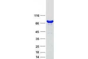 Western Blotting (WB) image for Cysteinyl-tRNA Synthetase (CARS) (Transcript Variant 1) protein (Myc-DYKDDDDK Tag) (ABIN2713187)