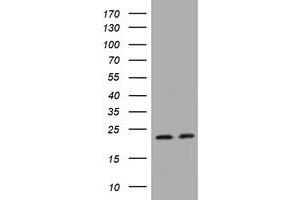 Image no. 1 for anti-GTPase Kras (KRAS) antibody (ABIN1499069) (K-RAS 抗体)
