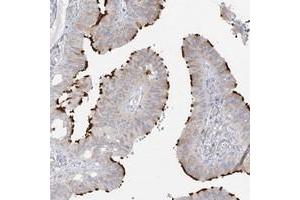 Immunohistochemical staining of human fallopian tube with LBA1 polyclonal antibody  shows distinct positivity in cilia of glandular cells. (LBA1 抗体)