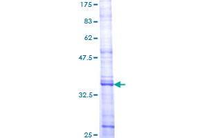 Image no. 1 for Discoidin Domain Receptor tyrosine Kinase 1 (DDR1) (AA 278-377) protein (GST tag) (ABIN1351298)