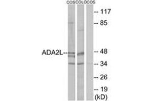 Western Blotting (WB) image for anti-Transcriptional Adaptor 2A (TADA2A) (AA 206-255) antibody (ABIN2889346) (TADA2L 抗体  (AA 206-255))