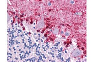 Immunohistochemistry (IHC) image for anti-Kruppel-Like Factor 2 (Lung) (KLF2) (Middle Region) antibody (ABIN2777573) (KLF2 抗体  (Middle Region))