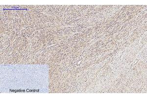 Immunohistochemical analysis of paraffin-embedded human uterus tissue. (MMP2 抗体  (AA 580-660))