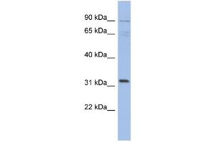 WB Suggested Anti-TBC1D14 Antibody Titration: 0. (TBC1D14 抗体  (N-Term))