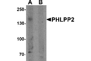 Western blot analysis of PHLPP2 in SW480 cell lysate with PHLPP2 antibody at 1 µg/mL in (A) the presence and (B) the absence of blocking peptide. (PHLPP2 抗体  (C-Term))