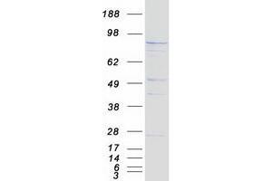 Western Blotting (WB) image for TEL2, Telomere Maintenance 2, Homolog (TELO2) protein (Myc-DYKDDDDK Tag) (ABIN2733407)