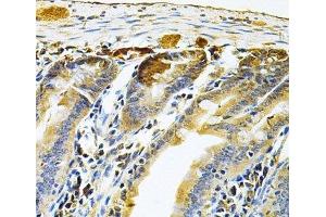 Immunohistochemistry of paraffin-embedded Mouse intestine using RRAGC Polyclonal Antibody at dilution of 1:100 (40x lens).