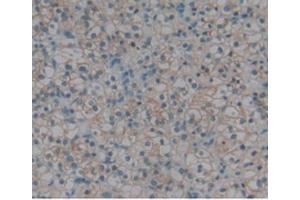 IHC-P analysis of Human Kidney, with DAB staining. (Renin 抗体  (AA 67-179))