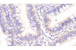 Detection of GOLPH2 in Human Small intestine Tissue using Polyclonal Antibody to Golgi Phosphoprotein 2 (GOLPH2) (GOLM1 抗体  (AA 119-223))