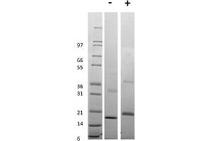 SDS-PAGE of Human Tumor Necrosis Factor Receptor Type 1 Recombinant Protein SDS-PAGE of Human Tumor Necrosis Factor Receptor Type 1 Recombinant Protein. (TNFRSF1A 蛋白)