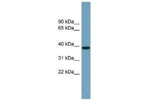 WB Suggested Anti-NUDCD3 Antibody Titration: 0. (NUDCD3 抗体  (Middle Region))