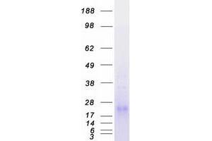 Validation with Western Blot