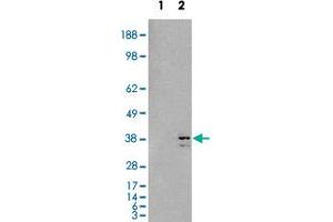 HEK293 overexpressing SIRT4 and probed with SIRT4 polyclonal antibody  (mock transfection in first lane), tested by Origene. (SIRT4 抗体  (C-Term))