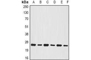 Western blot analysis of BNIP1 expression in MCF7 (A), Jurkat (B), mouse testis (C), mouse pancreas (D), rat brain (E), rat liver (F) whole cell lysates. (BNIP1 抗体)