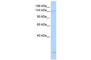 SMC4 antibody used at 1 ug/ml to detect target protein. (SMC4 抗体  (N-Term))