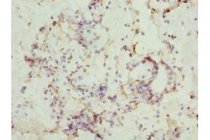 Immunohistochemistry (IHC) image for anti-Casein Kinase 1, gamma 1 (CSNK1G1) (AA 298-422), (Isoform gamma 1) antibody (ABIN7146874)