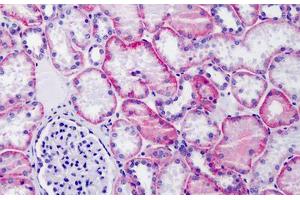 Human Kidney: Formalin-Fixed, Paraffin-Embedded (FFPE) (CD147 抗体  (N-Term))