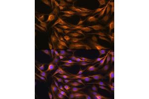 Immunofluorescence analysis of C6 cells using SO Rabbit pAb (ABIN6129624, ABIN6148259, ABIN6148260 and ABIN6221917) at dilution of 1:100. (SOAT1 抗体  (AA 1-130))