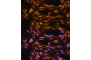 Immunofluorescence analysis of C6 cells using SO Rabbit pAb (ABIN6129624, ABIN6148259, ABIN6148260 and ABIN6221917) at dilution of 1:100. (SOAT1 抗体  (AA 1-130))