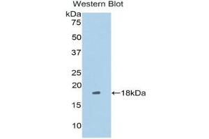 Western Blotting (WB) image for anti-Leucine Rich Repeat (In FLII) Interacting Protein 1 (LRRFIP1) (AA 128-250) antibody (ABIN1859714) (LRRFIP1 抗体  (AA 128-250))