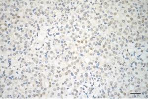Immunohistochemistry was performed on paraffin-embedded mouse kidney using RHOA antibody (ABIN7800142), 1:200).