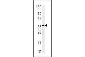 Western blot analysis of anti-RBSK Pab in HepG2 cell line lysate (35 µg/lane). (Ribokinase 抗体  (N-Term))