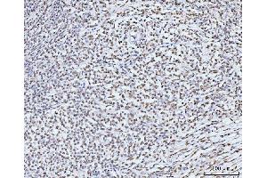 IHC analysis of KIFC1 using anti-KIFC1 antibody (ABIN7599523).