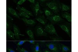 Immunofluorescence analysis of U-2 OS cells using NDUFB4 Polyclonal Antibody at dilution of 1:100 (40x lens). (NDUFB4 抗体)