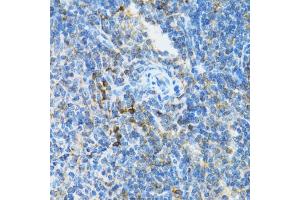 Immunohistochemistry of paraffin-embedded mouse spleen using UBE2D1 antibody (ABIN3015751, ABIN3015752, ABIN3015753 and ABIN6219101) at dilution of 1:100 (40x lens). (UBE2D1 抗体  (AA 1-147))
