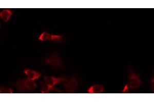 ABIN6267002 staining HeLa by IF/ICC. (MRRF 抗体  (Internal Region))