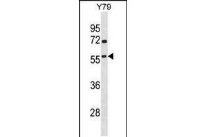 Western blot analysis in Y79 cell line lysates (35ug/lane). (TAF1A 抗体  (N-Term))