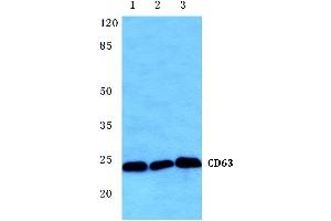 Western blot (WB) analysis of CD63 antibody at 1/500 dilution (CD63 抗体)
