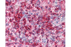 Immunohistochemistry (IHC) image for anti-Vacuolar-sorting Protein SNF8 (SNF8) (N-Term) antibody (ABIN2777341)