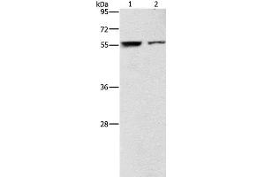 Western Blot analysis of Jurkat and 293T cell using ARHGAP15 Polyclonal Antibody at dilution of 1:500 (ARHGAP15 抗体)
