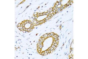 Immunohistochemistry (IHC) image for anti-Valyl-tRNA Synthetase (VARS) (AA 1-280) antibody (ABIN1683239)