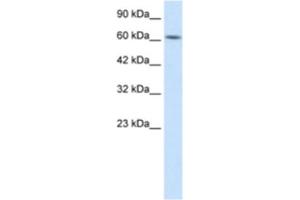 Western Blotting (WB) image for anti-Kelch-Like 28 (KLHL28) antibody (ABIN2460991) (KLHL28 抗体)