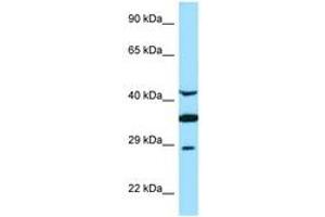 Image no. 1 for anti-Torsin Family 1, Member A (Torsin A) (TOR1A) (AA 201-250) antibody (ABIN6748405) (TOR1A 抗体  (AA 201-250))