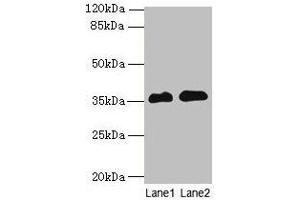 Western blot All lanes: RFPL3 antibody at 8 μg/mL Lane 1: Human placenta tissue Lane 2: HL60 whole cell lysate Secondary Goat polyclonal to rabbit IgG at 1/10000 dilution Predicted band size: 36, 33 kDa Observed band size: 36 kDa (RFPL3 抗体  (AA 8-288))