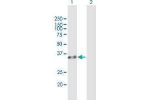 Western Blot analysis of RLBP1 expression in transfected 293T cell line by RLBP1 MaxPab polyclonal antibody. (RLBP1 抗体  (AA 1-317))
