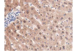 Immunohistochemical staining of paraffin-embedded Human liver tissue using anti-PRPSAP2 mouse monoclonal antibody. (PRPSAP2 抗体)